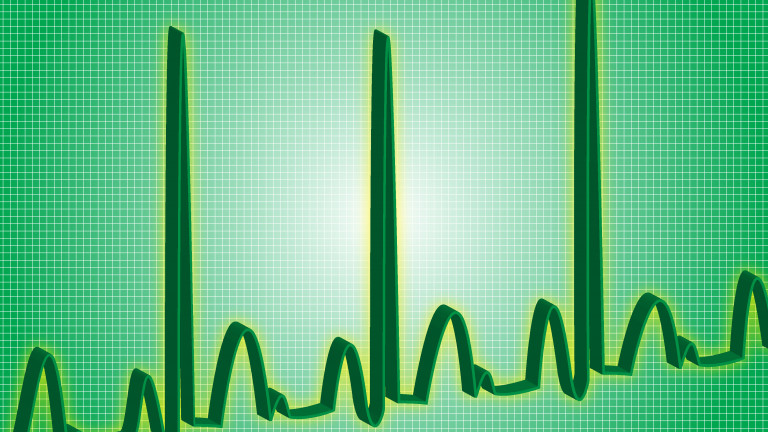 Heart beat line read-out