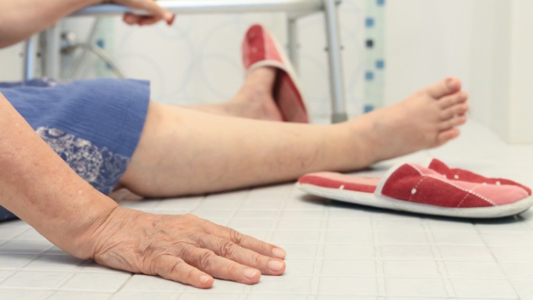 Leg of elderly woman on bathroom floor depicting a bone fracture