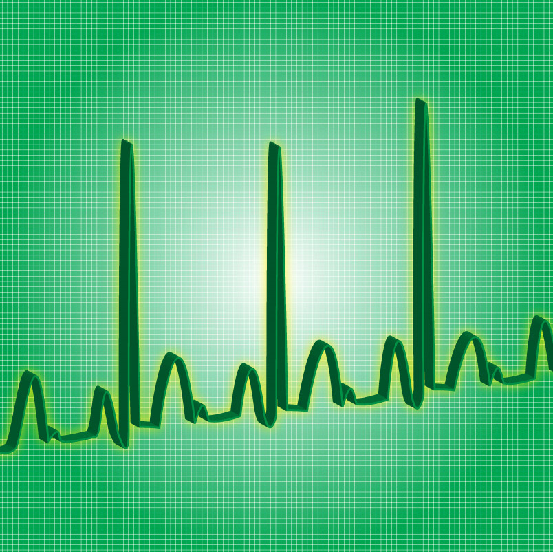 Heart beat line read-out