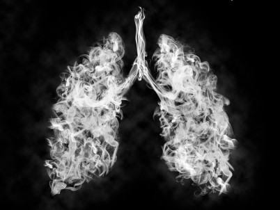 illustration of Lung cancer